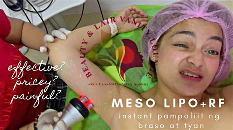 mesotherapy gone wrong|is mesolipo safe.